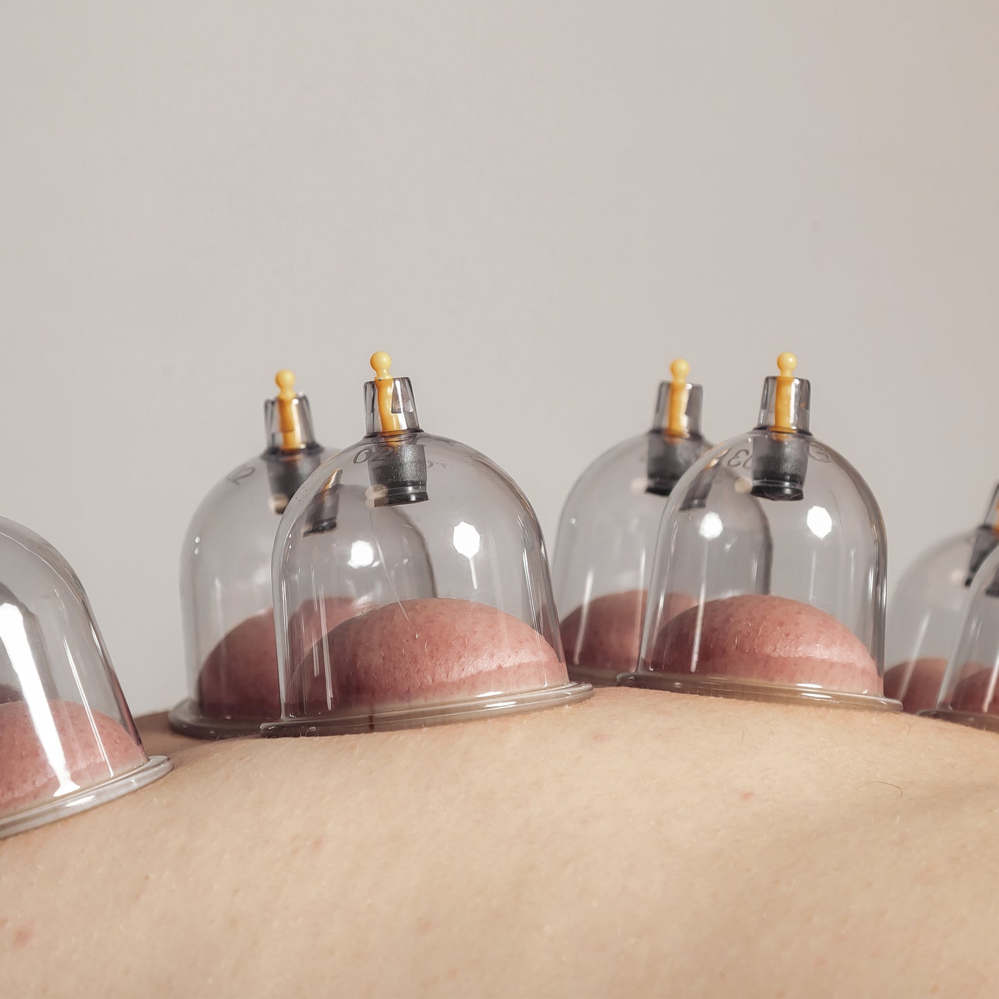 Cupping (1 jour)