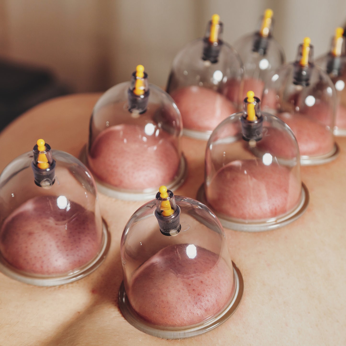 Cupping (1 jour)
